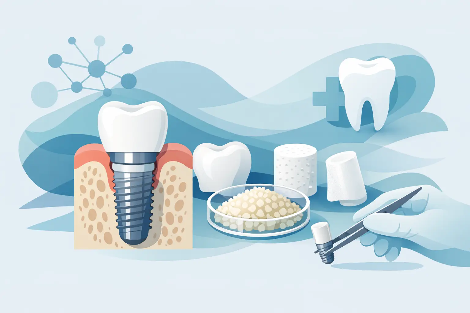 Guía de biomateriales para implantología dental